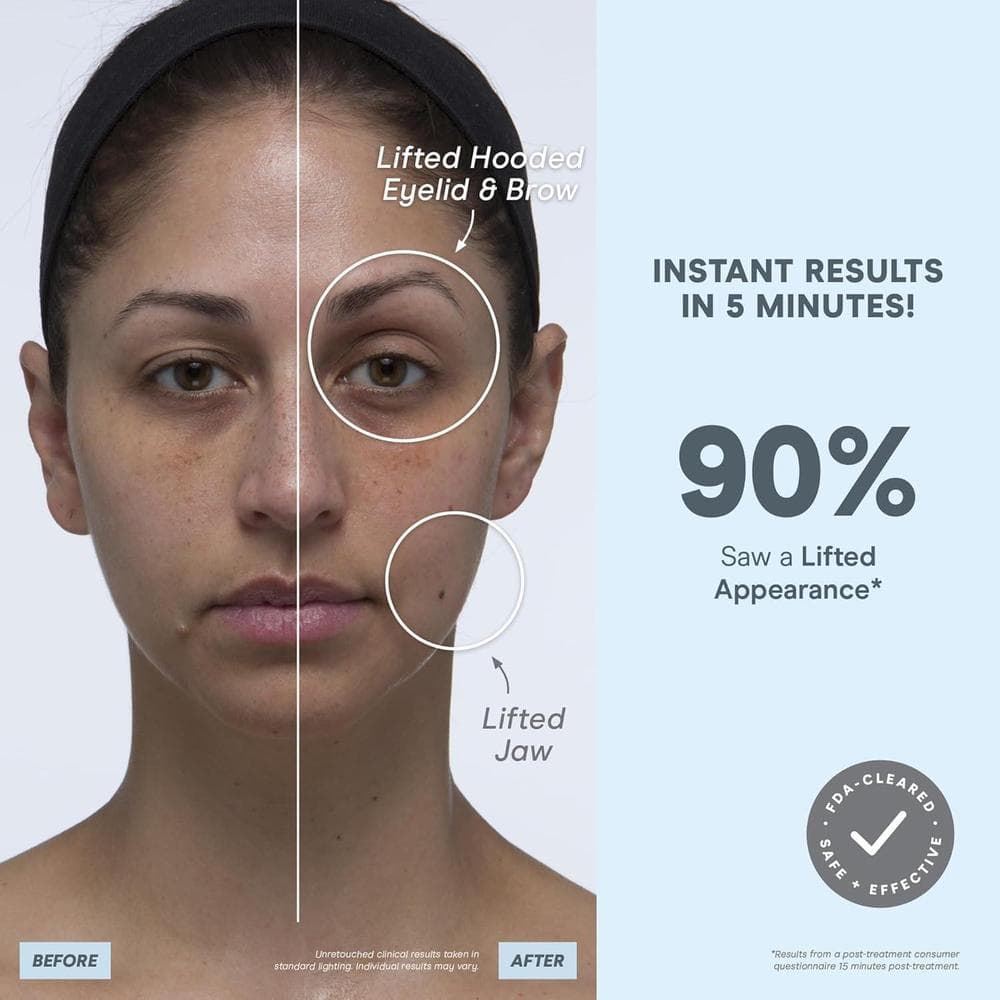 NuFACE MINI+ Kit De Dispositivo Facial De Microcorriente Para Esculpir, Levantar Y Tonificar La Piel, Aprobado Por La FDA
